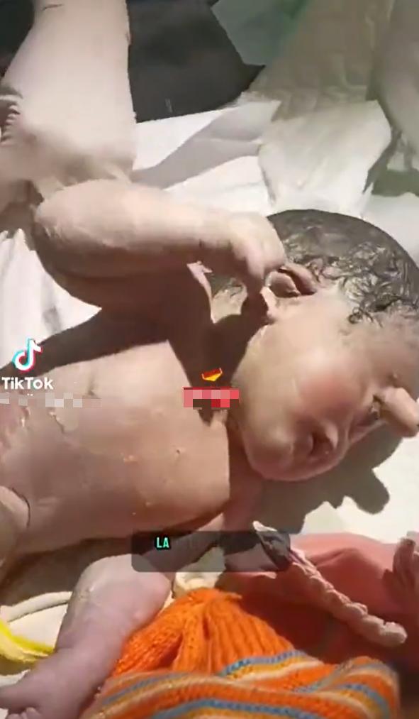 一则帖子展示了一段视频，画面中是一名患有独眼畸形（即仅有一只位于正中央的眼睛）且