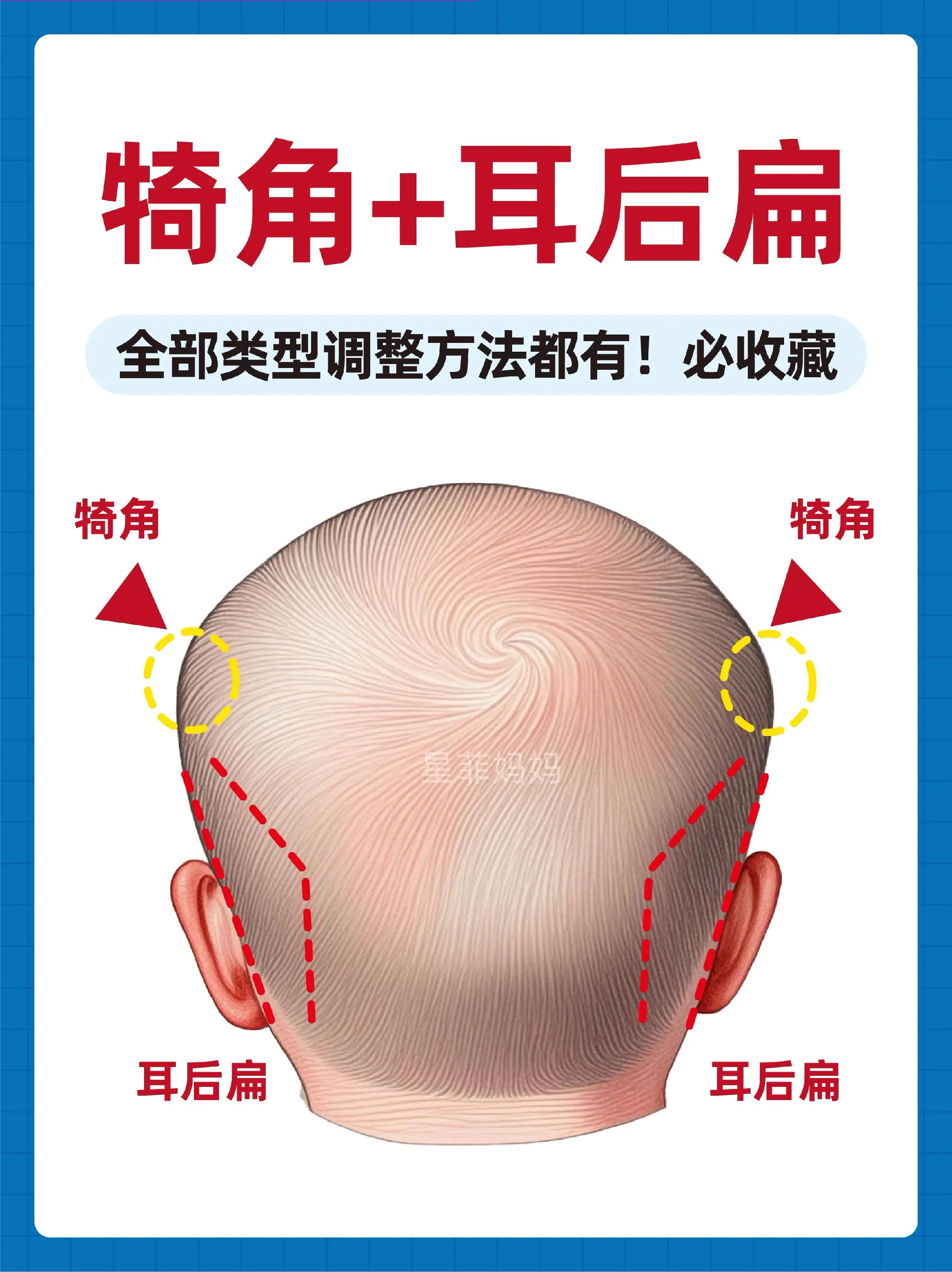 宝宝头型|犄角➕耳后扁如何调整✅一篇讲明。