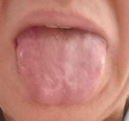 气血亏虚易致精力变差，一方疏通脉络，温和调养身心






对于男同志而言最忌