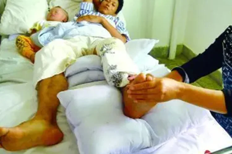 骨折正确垫腿的方法图片