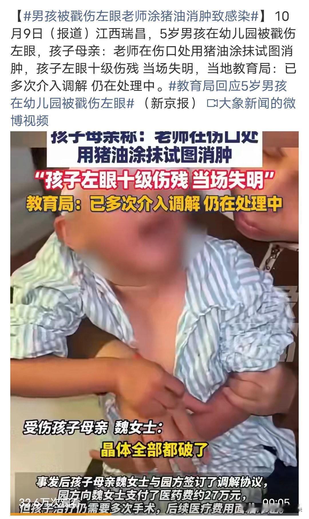 这都是些什么操作啊？
话说眼镜被戳伤了，第一时间应该是送医院治疗啊，怎么会拿猪油