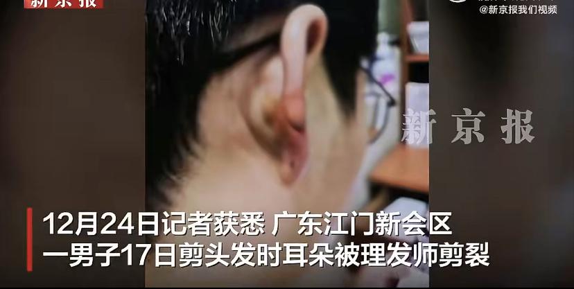 近日，广东江门一男子在理发时遭遇意外。12月17日，理发师不慎将其耳朵剪伤，伤口
