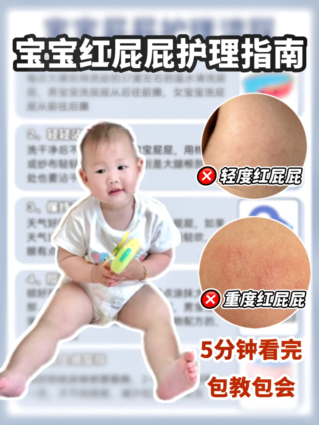 百战百胜的红pp护理大法！新手一看就会