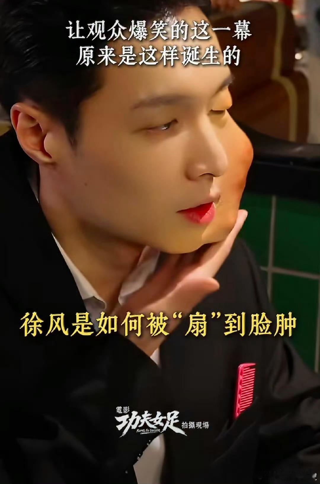张艺兴肿脸特效妆佩服张艺兴的演员素养，为《功夫女足》适配肿脸特效妆，主动放下帅气