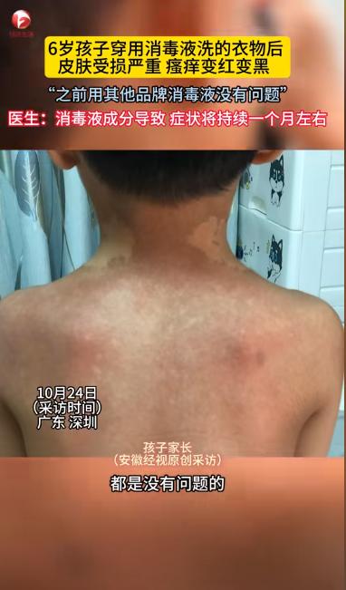 “悲剧还是发生了！”近日，广东深圳，一家长用洗衣机给儿子洗衣服时，特地加了1瓶盖