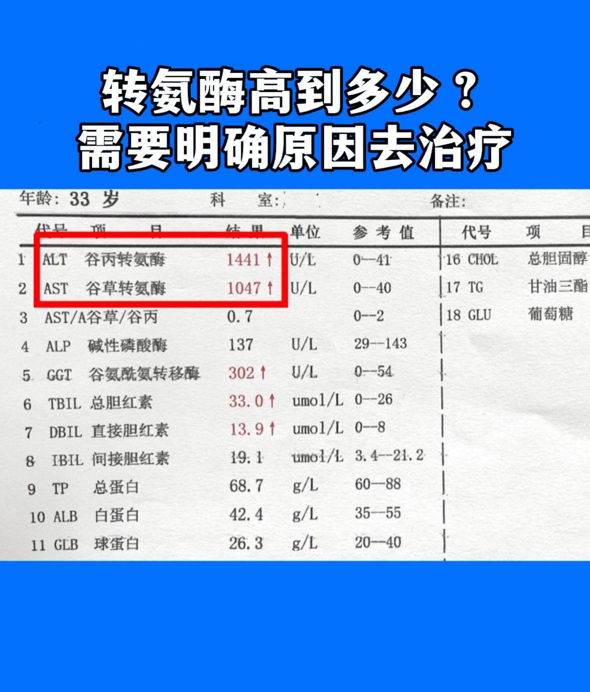 转氨酶高到多少？需要明确原因去治？  “教授，我近期浑身没劲，皮肤还发...