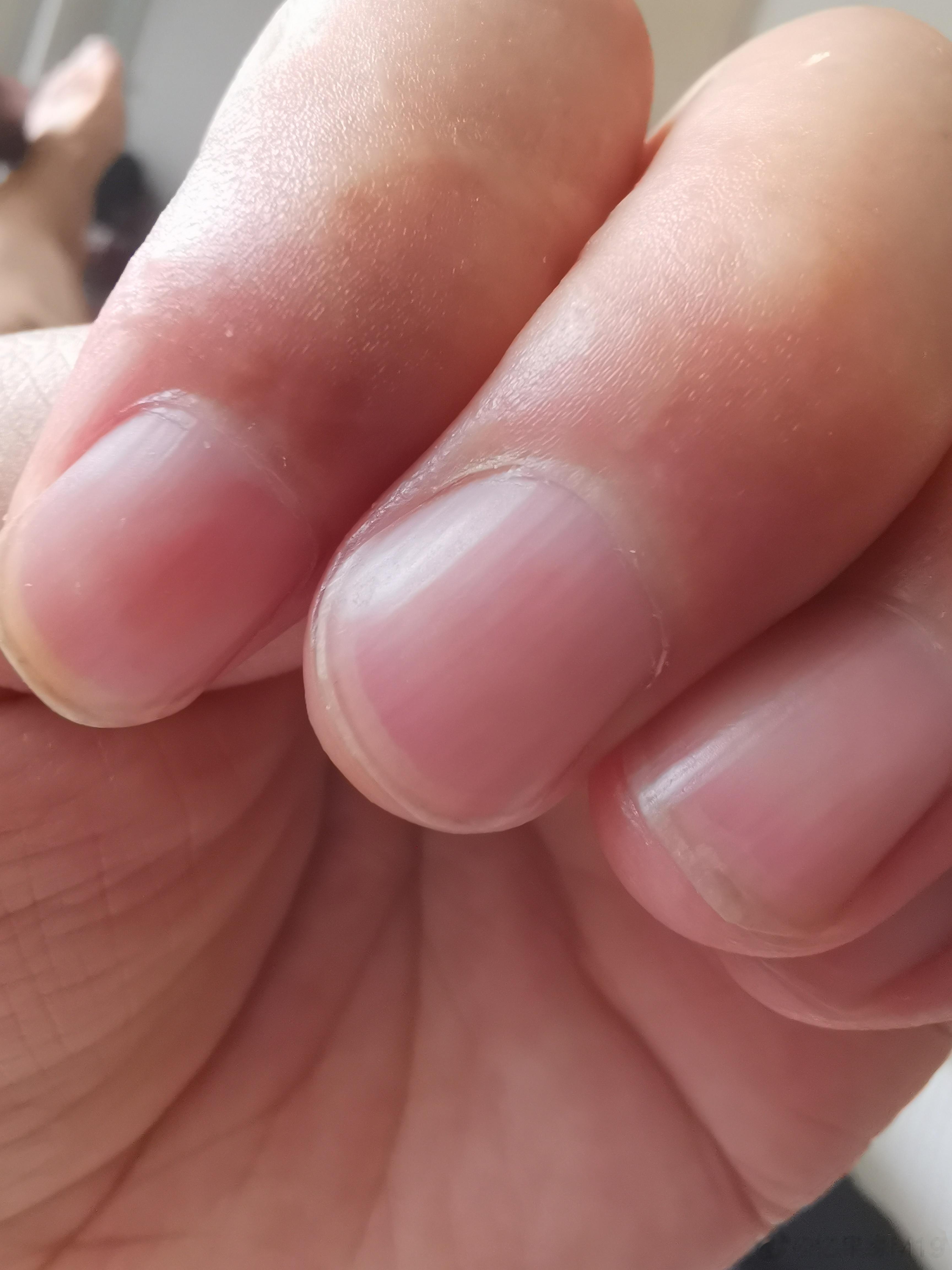 指甲上长“竖纹”？留意这4种异常，可能是癌或疾病的信号人的身体很奇妙，是否健康通