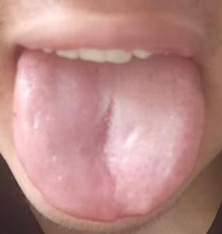 宗筋疲软难振作，补足命门之火一身强健





很多朋友到了中年就出现了宗筋不振