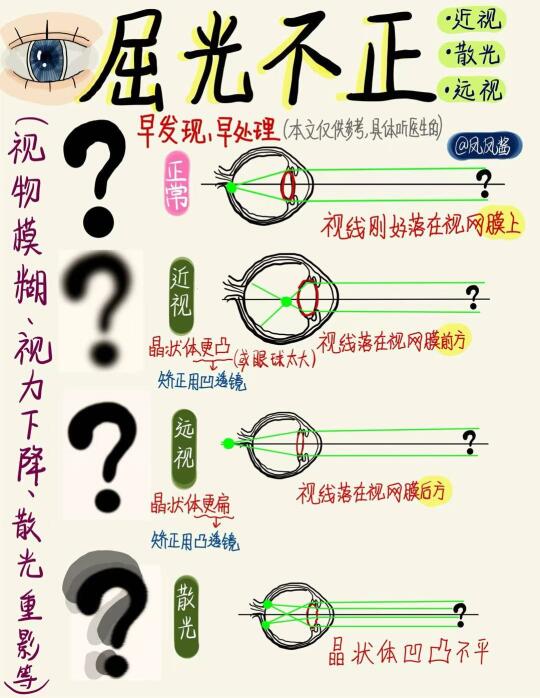 📖手绘笔记| 屈光不正 建议点赞收藏