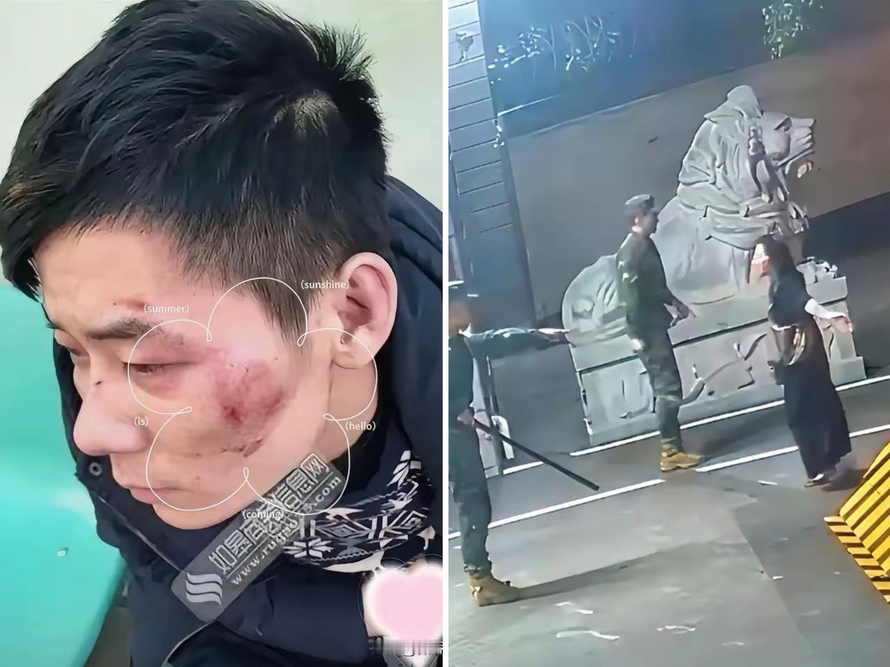 四川深夜街头惊险一幕，大哥这波求生智慧直接拉满
 
不得不说，人在危难时刻的临场