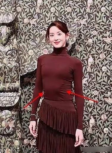 章泽天肋骨外翻这是什么原因 ​​​