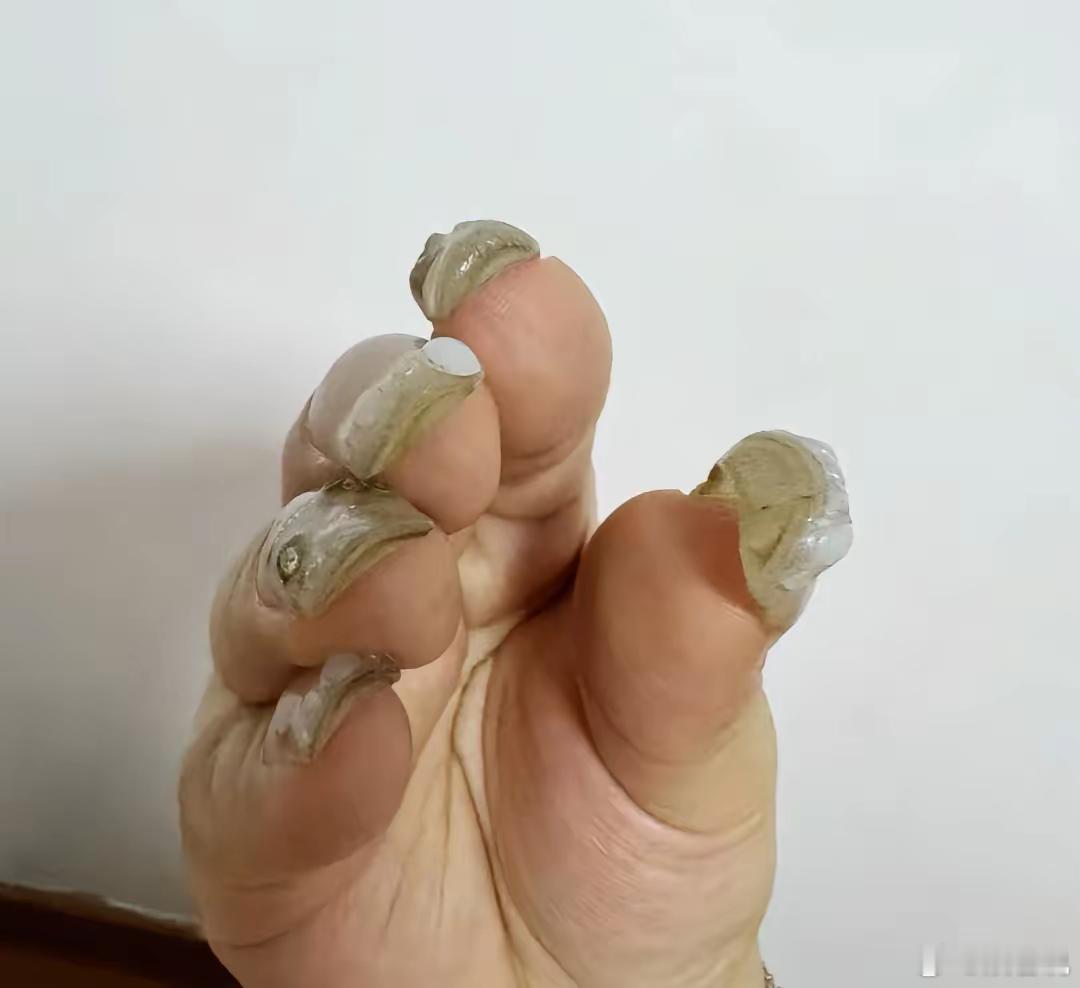 我老公说我的指甲比他爸爸的脚趾还厚。花了168，真的很丑吗？ ​​​