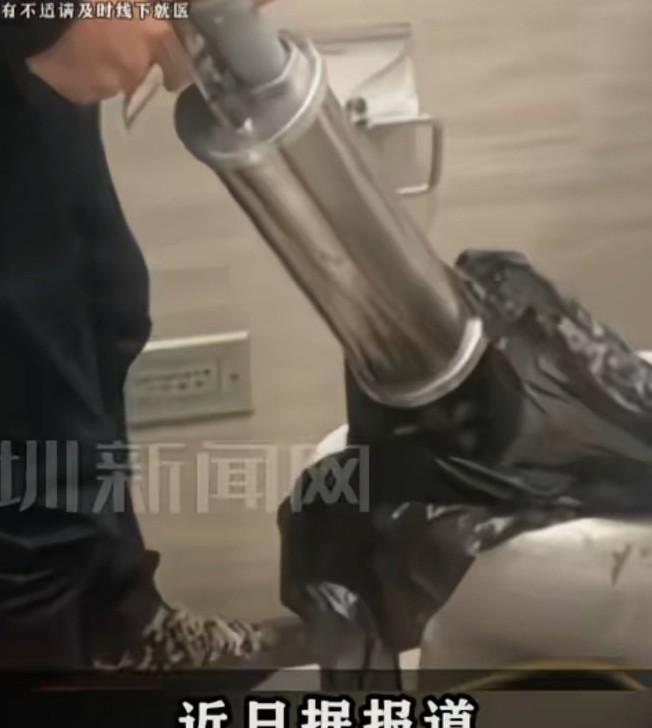 广东一市民在家通厕所，
被化骨水烧伤全身多处进了ICU，30分钟内两度心律失常，