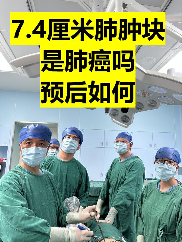 咳嗽伴胸痛，发现右肺7.4厘米肿块。周三出门诊，来了一位50岁的女性患...