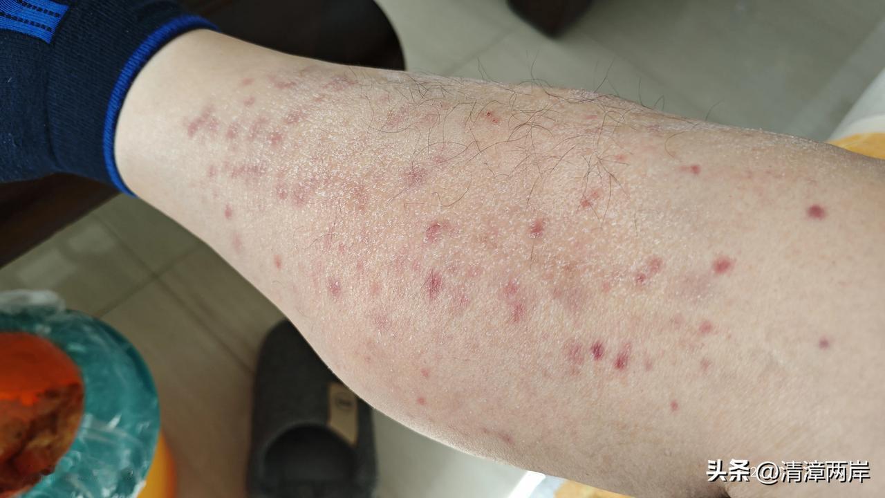 拍痧管用吗？今天胃口有点不舒服，腿肚子还有点疼，朋友建议我用拍痧板把毒素逼出来，
