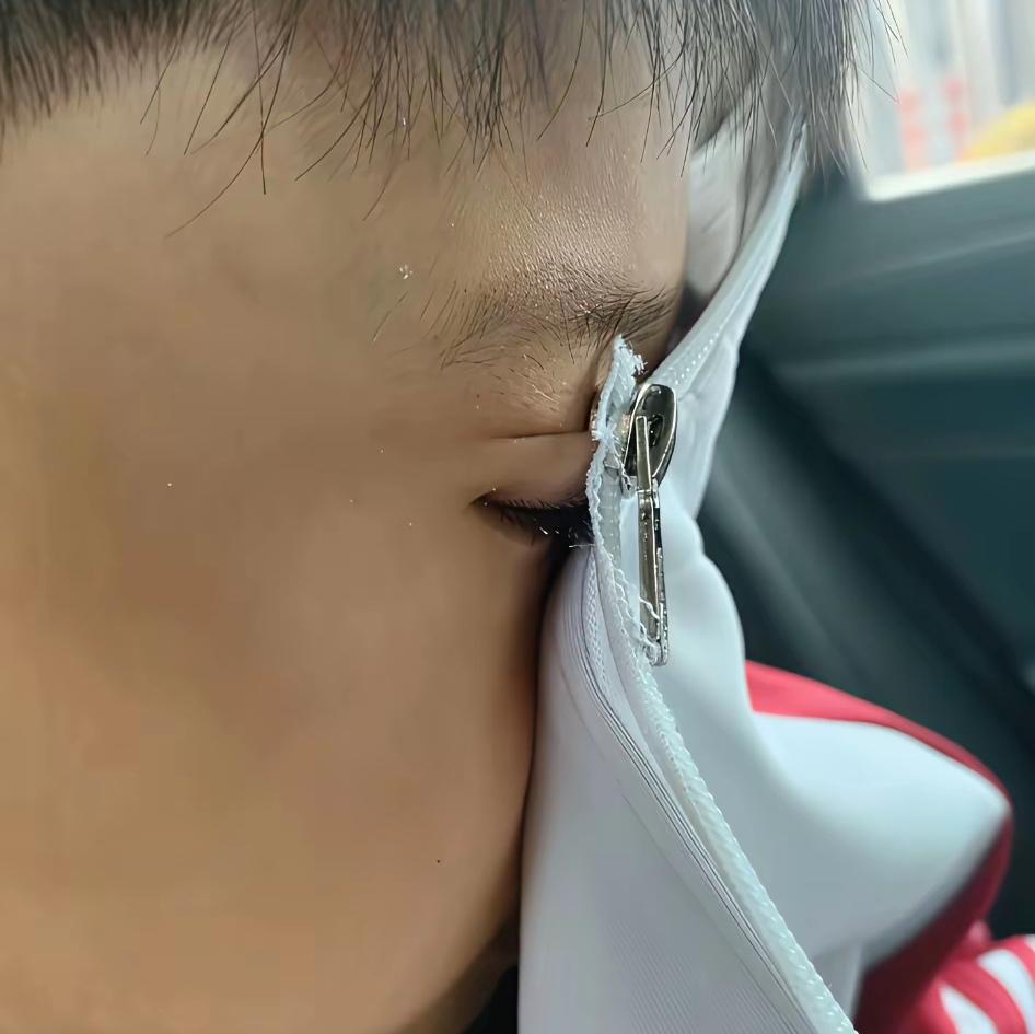 你敢信？就因为拉拉链太急，这小物件成了眼皮上的“紧箍咒”。消防员立马分工：一人拍