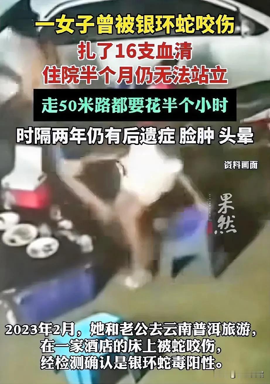 银环蛇真的太毒了[泣不成声]！一女子2年前去云南普洱旅游，夜晚躺酒店床上被银环蛇