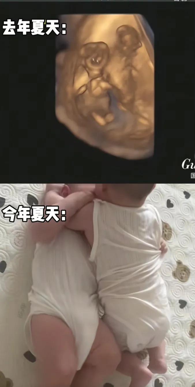 太可爱了，这一对双胞胎。去年还在妈妈的肚子里，一起和平共处了十个月，怎么出生后，