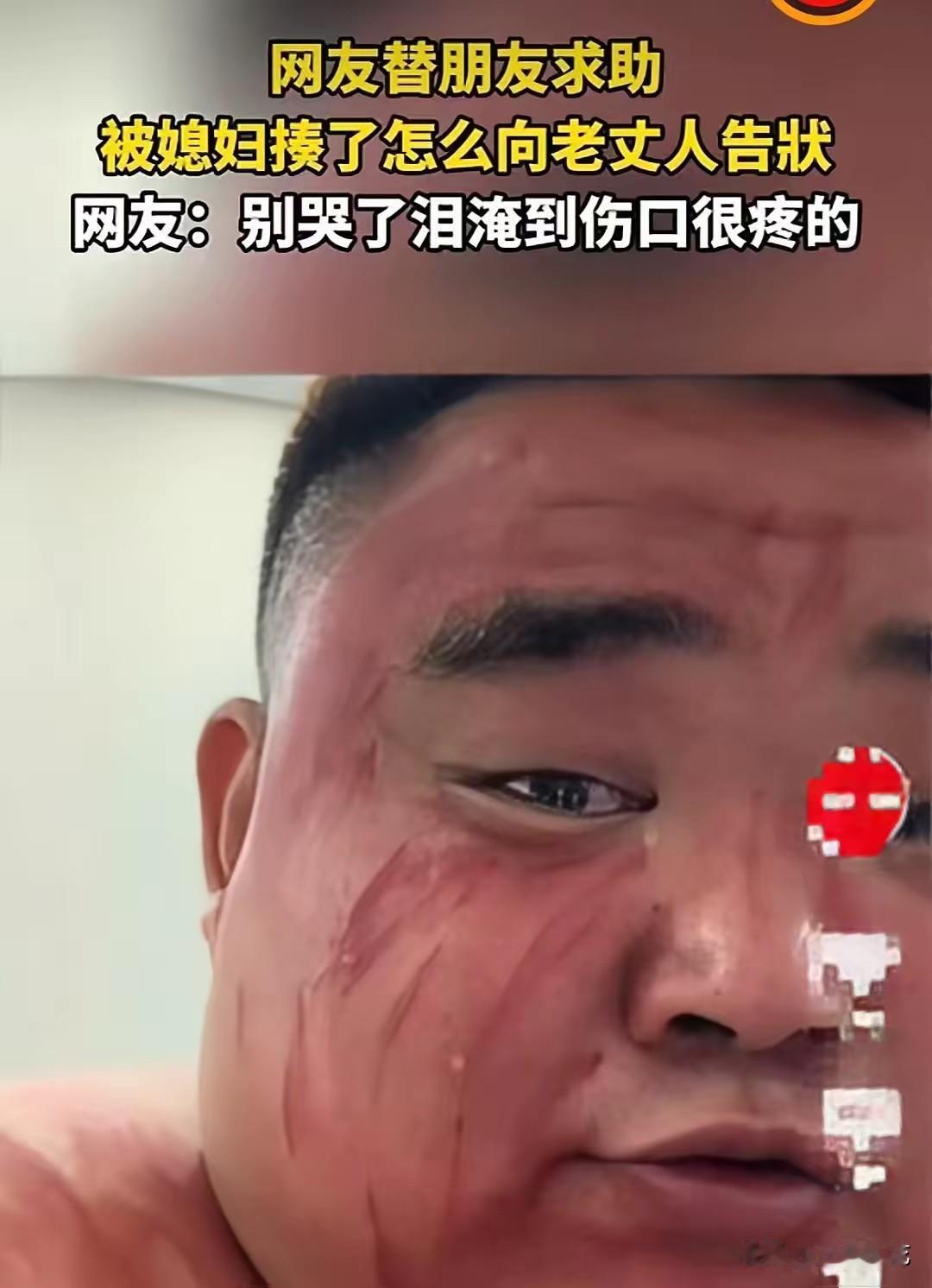 湖北，一男子被媳妇打了，躲到朋友家哭诉，说要去老丈人那告状。谁知，他一连蹲了两天