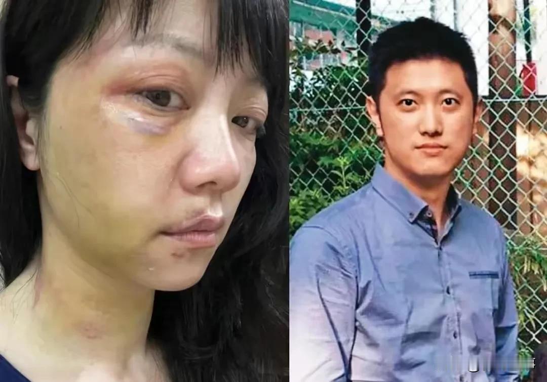 两年前高嘉瑜被渣男前男友暴力殴打，并窃取私密影像！
    台北地院近日裁定，前