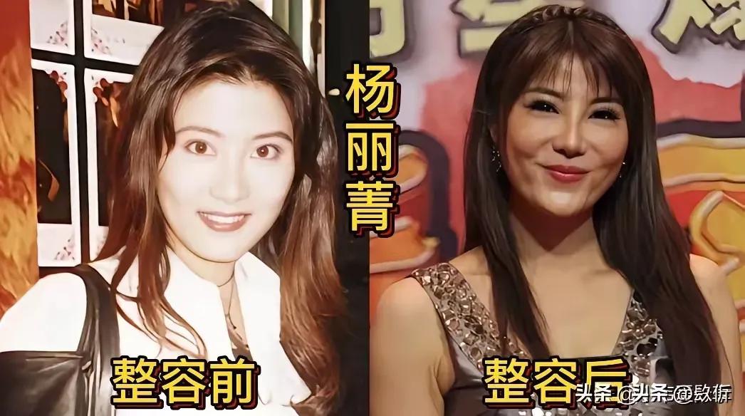 曾经整过容的柳岩。
曾经整过容的王心凌。
曾经整过容的郑裕玲。
曾经整过容的熊黛
