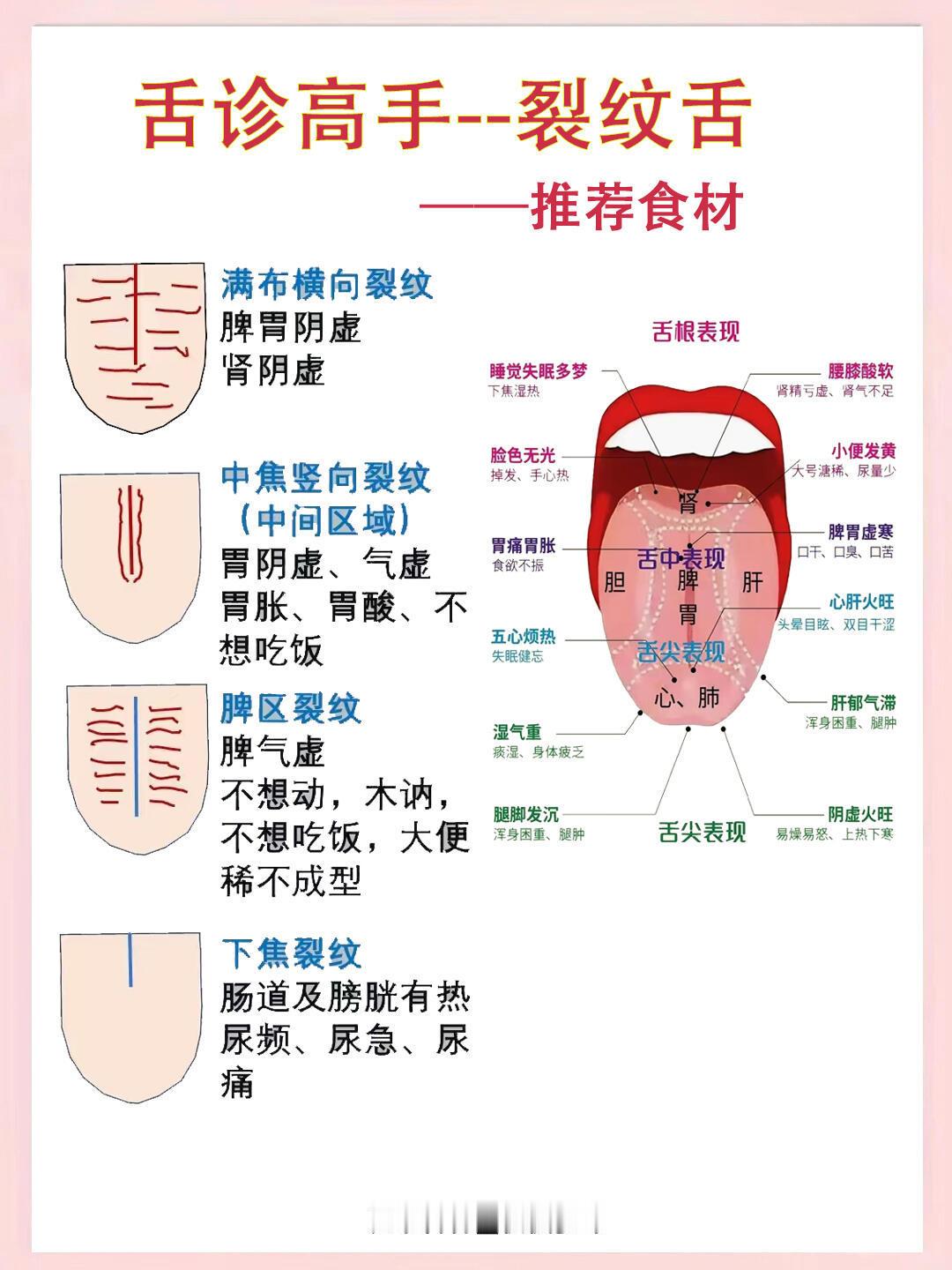 中医认为舌头裂纹越多、越重，影响长shou！ 