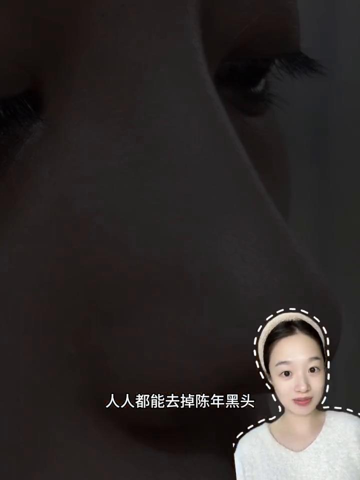 30秒去黑头跟练，人人都能去掉陈年黑头。
·Step1：生理盐水湿敷。用几块钱的