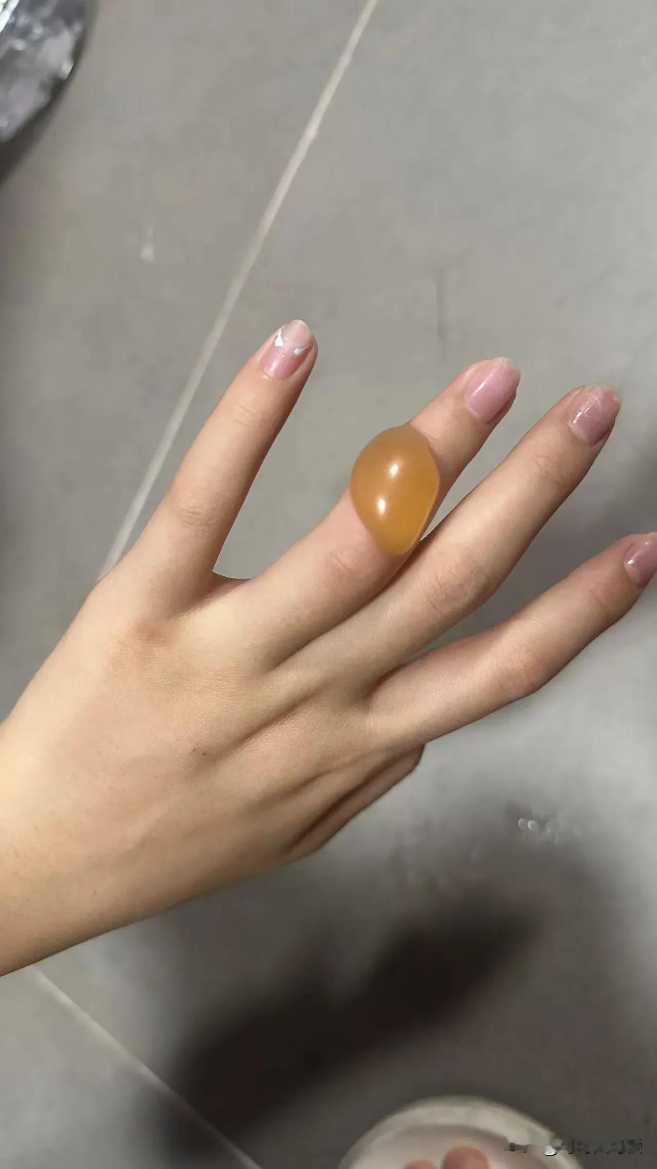 到底能不能戳破！被烫水烫的 学校的校医说不要戳破 ，会感染 ，但是网上也有人说要
