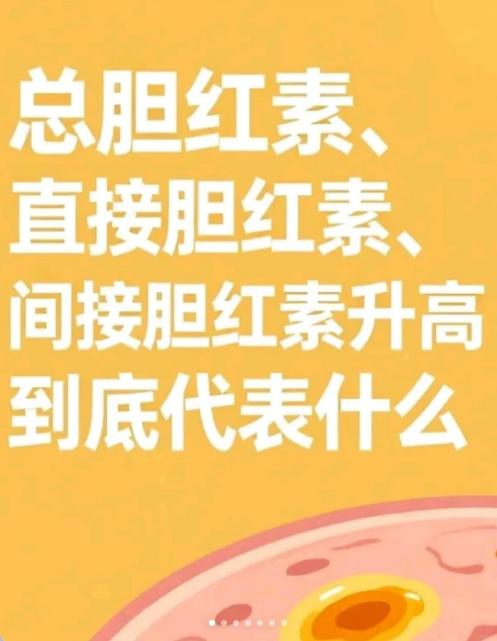 胆红素三兄弟的前世今生，一张化验单看懂！
很多人查肝功能，都会被胆红素三项绕晕。