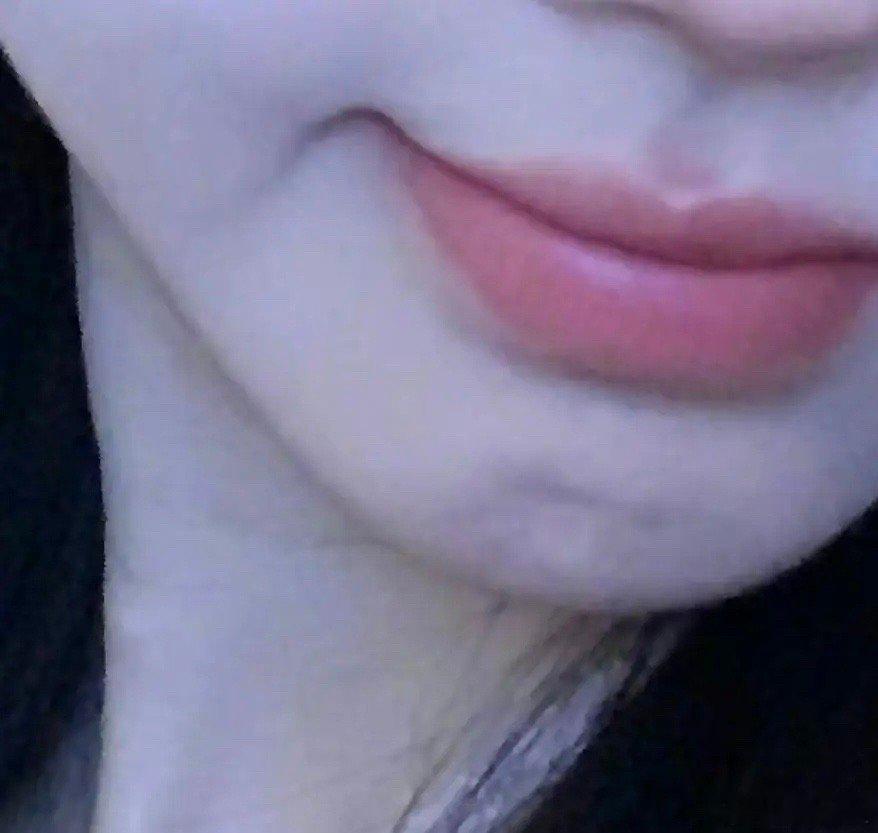 鞠婧祎和杨紫一样的肌肤问题 ​​​