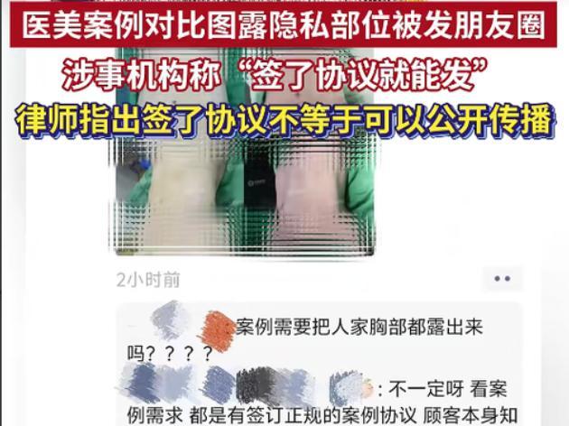 一条推广腹部医美项目的素材里，清晰露出顾客胸部，乳头、乳晕，没有任何遮挡和打码处