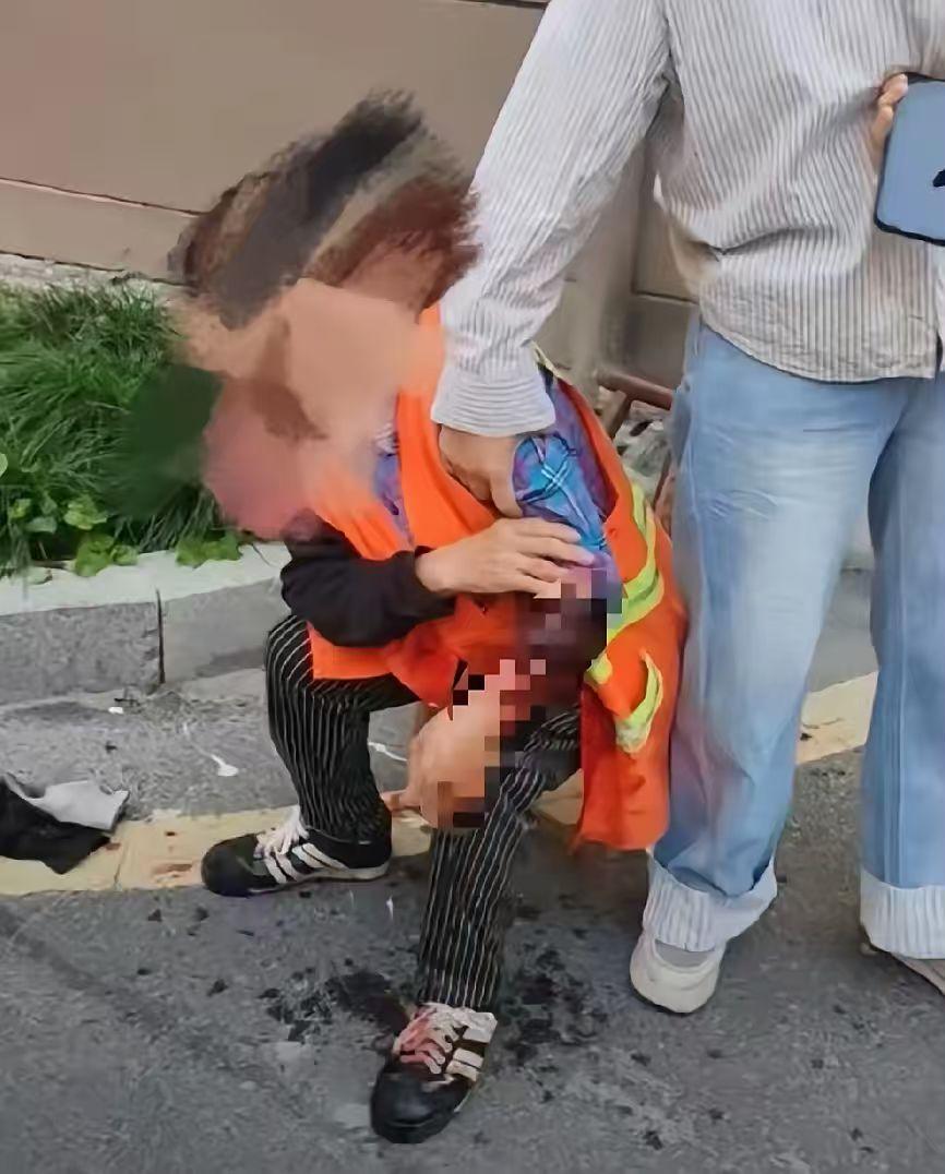 黄阿姨手臂伤势危重送医救治，自觉、教育永远也解决不了问题，唯有重罚、重判可以解决