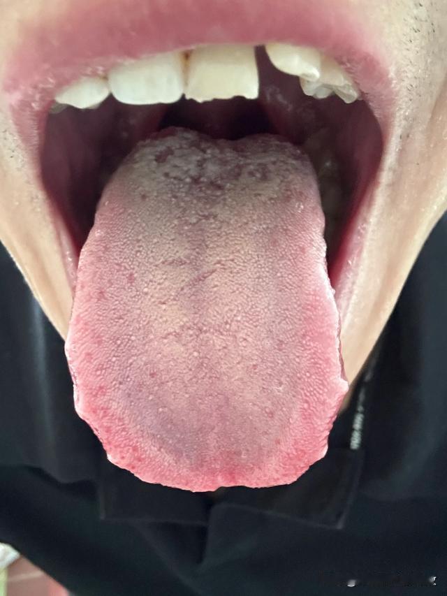 年龄不大，身体可真够差的，10个男的9个虚，真不是白说的[狗头][狗头][狗头]