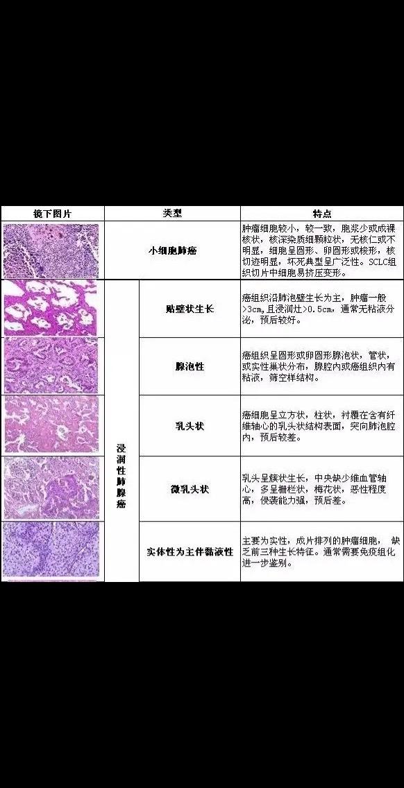 2张图片带你了解肺癌的病理类型！