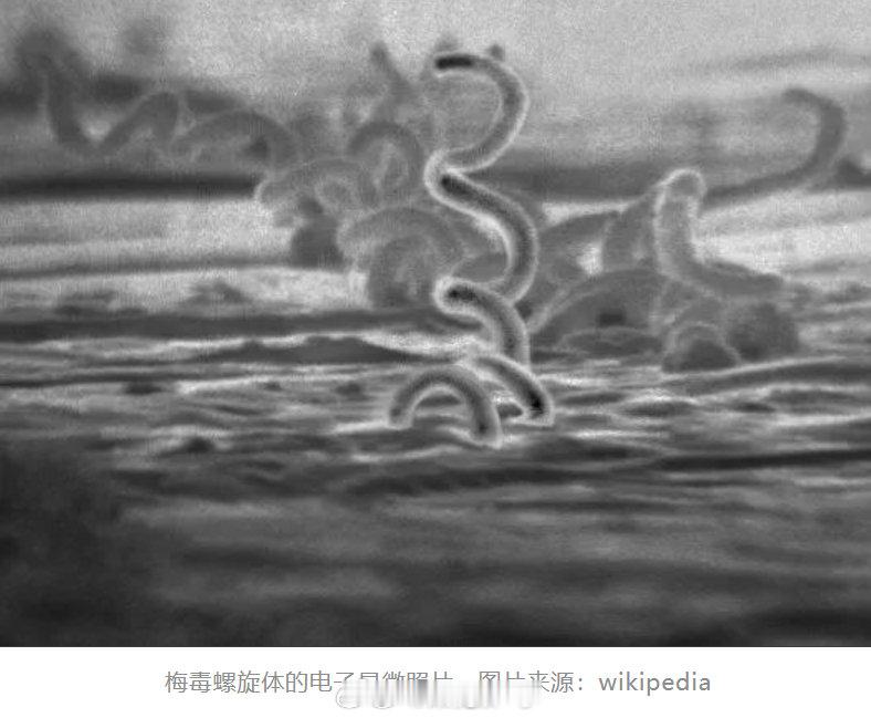 【梅毒有哪些传播方式，常规使用马桶垫得会得梅毒吗？】#梅毒患者为梅毒唯一传染源#