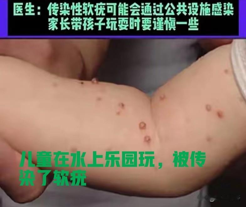暑假将至，莫带娃去这些地方！

炎热的夏天，水上乐园是一个热门休闲场所，各个年龄
