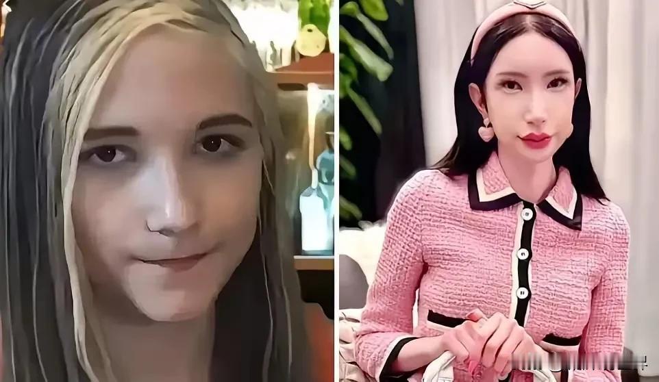 不要再盲 目崇 拜韩国整 容术了！看把好好的一个混血儿大美女，活活整成一个吓 死