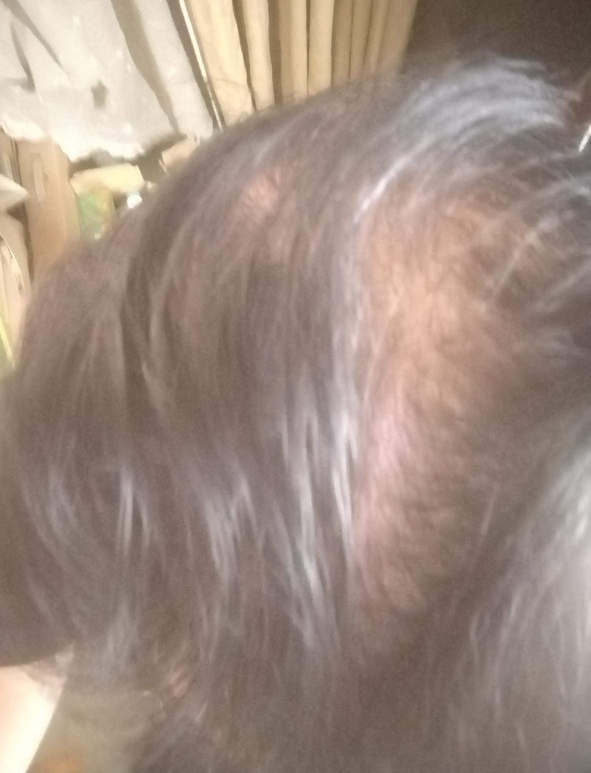 稀疏的头发，足以证实他已经老了