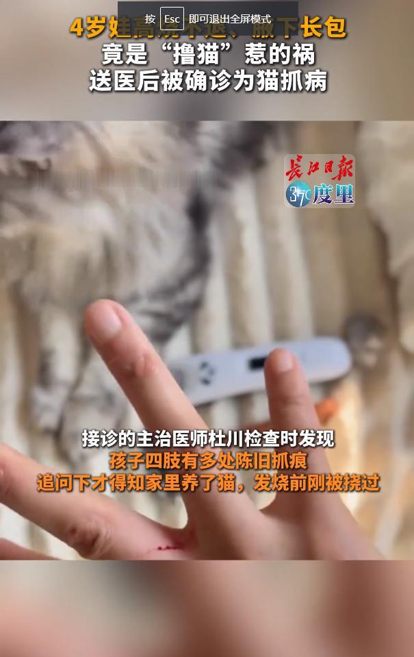 "万万没想到！"9月17日报道，湖北武汉，一小男孩连续两天发烧，妈妈摸到他腋下有