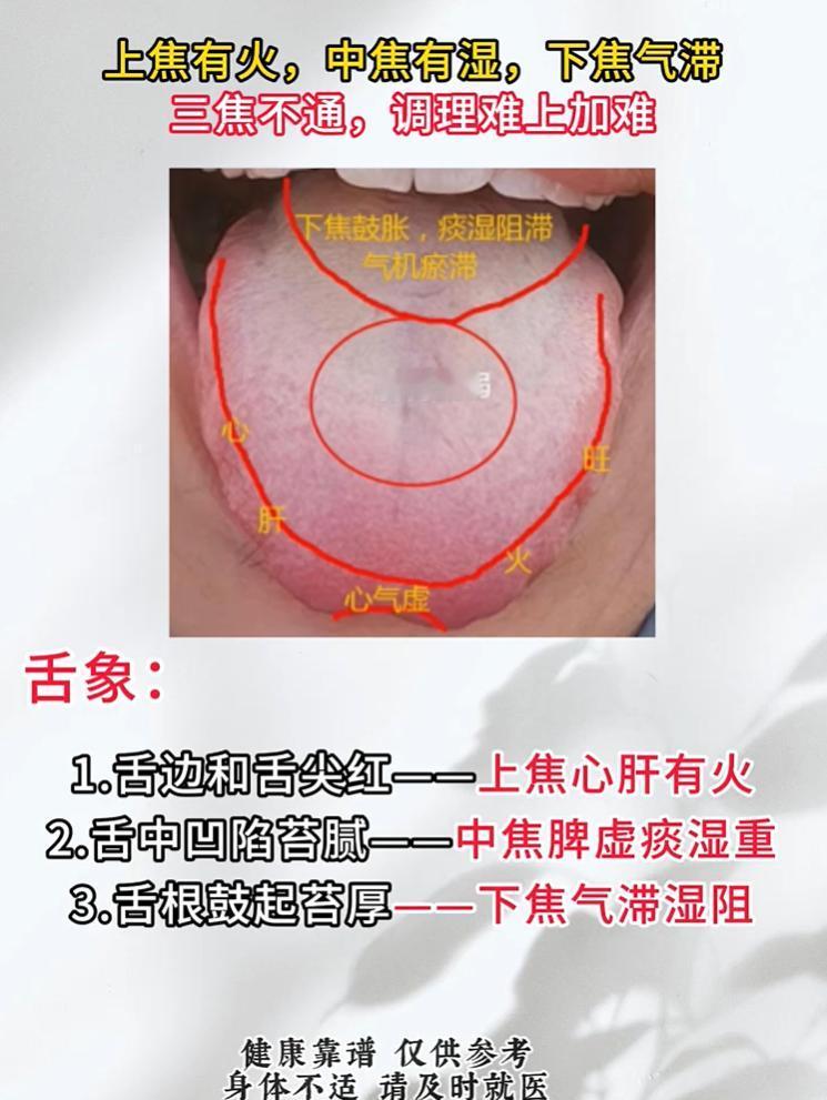 三焦不通影响海绵体，调理先分清上中下