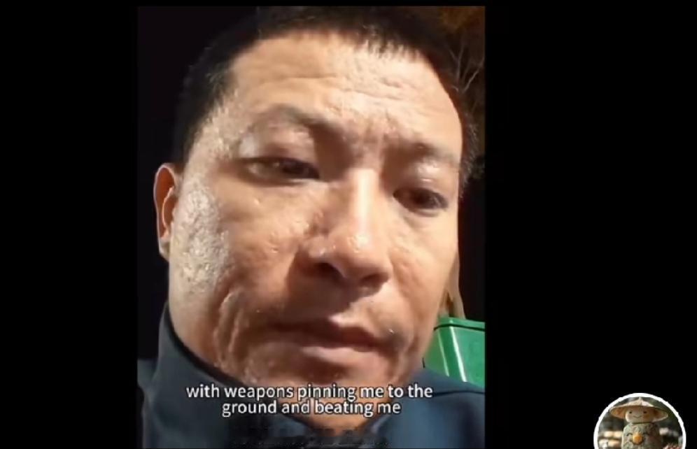 前几年，吹嘘乌克兰多能打的帖子不少，我早就说过，凡是美国支持过的军队都是菜鸡，有