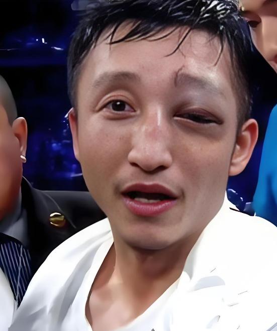 靠一拳一拳打来的2个亿，三年完美亏完了，还负债累累。退役时左眼视力只剩0.1，本