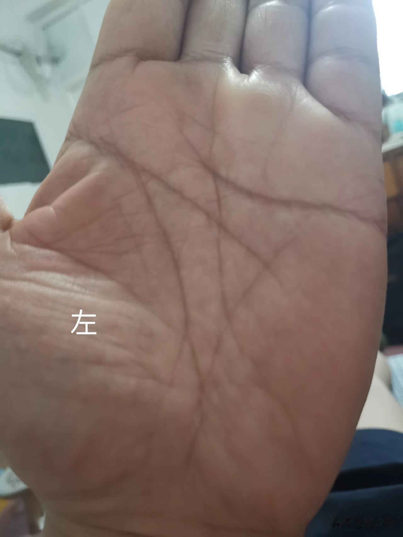 吓了一跳，今天突然发现，我的双手都长有通天纹，记忆里左手原是没有的。相书称，少见