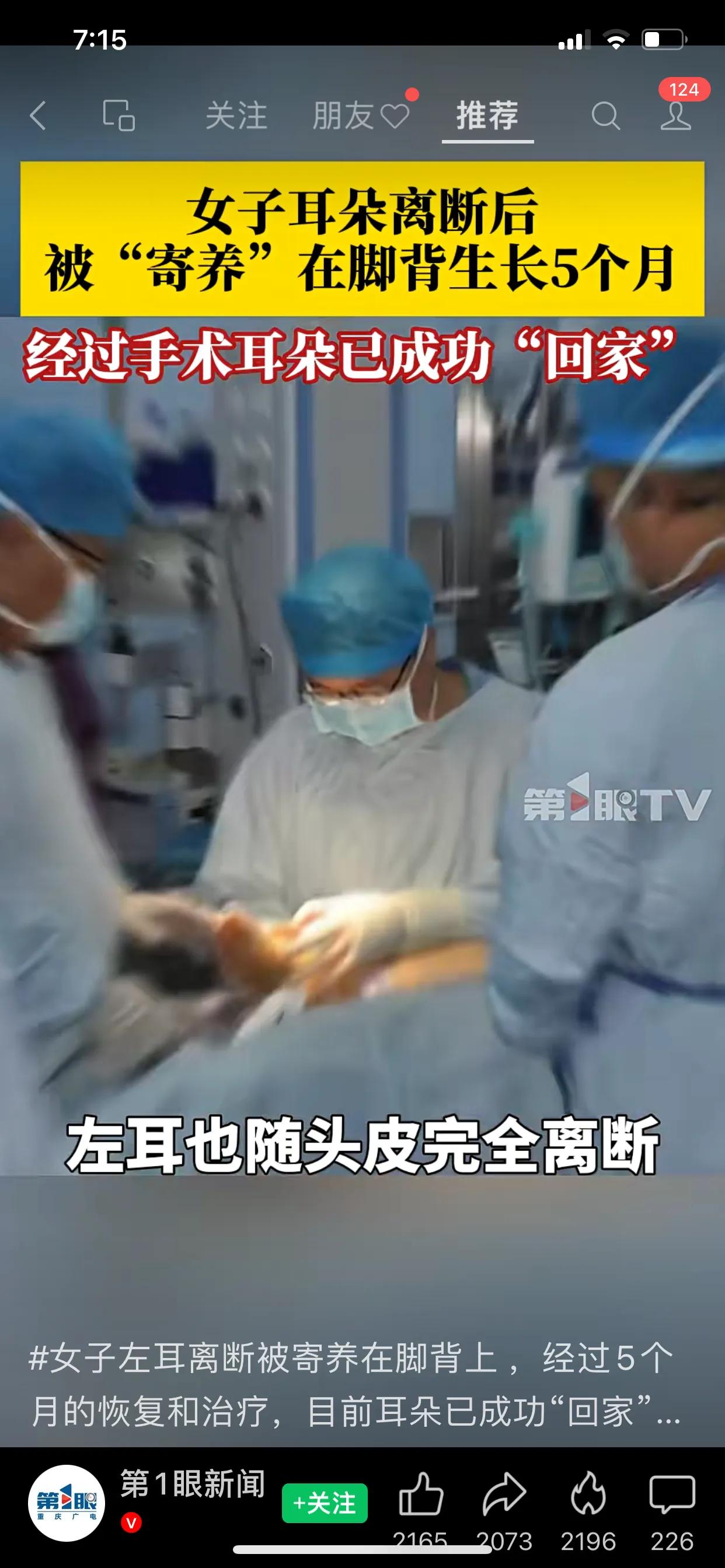 惊呆了！女子左耳离断被寄养在脚背上 ，经过5个月的恢复和治疗，目前耳朵已成功“回