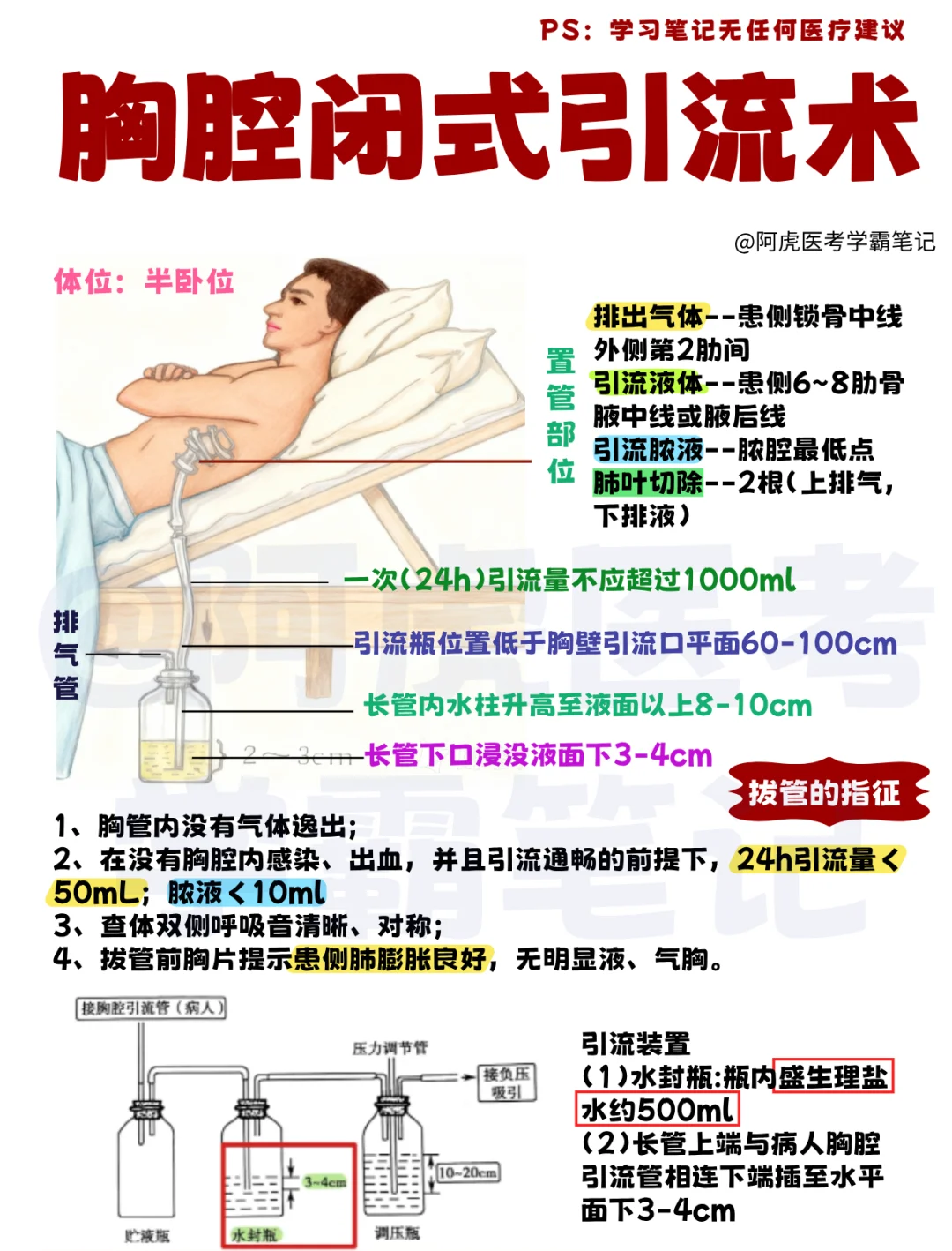 一张图搞定📕｜胸腔闭式引流术