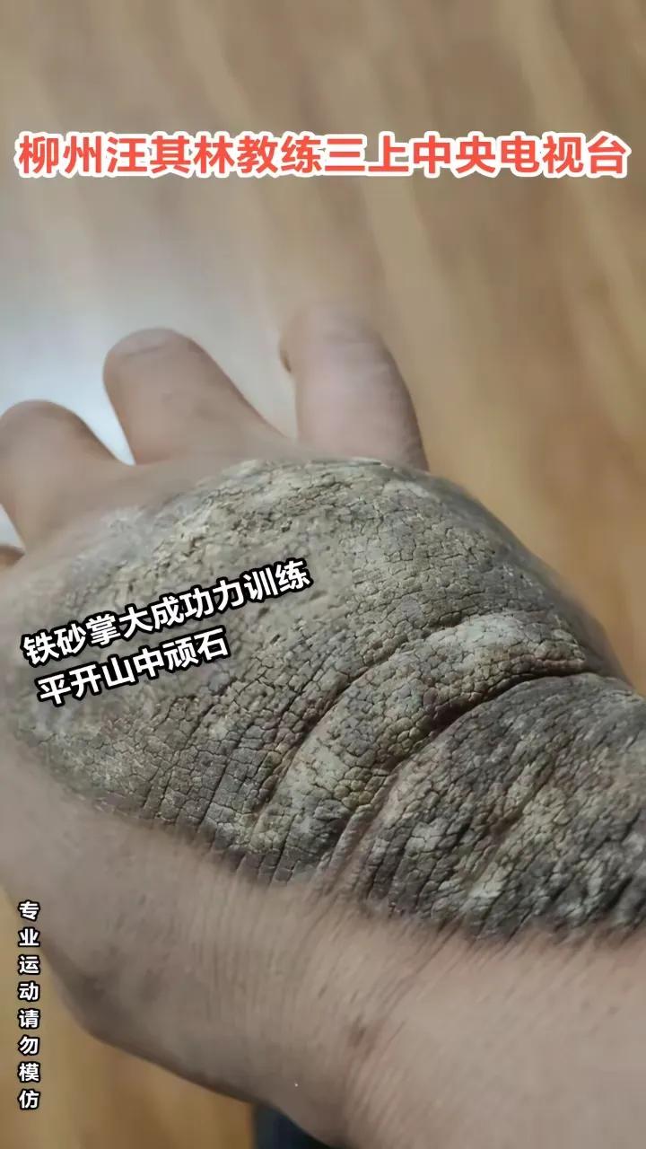 你敢相信，这是一只人的手？他不是得了什么病，而是长期练功自然形成的。
据说，这只