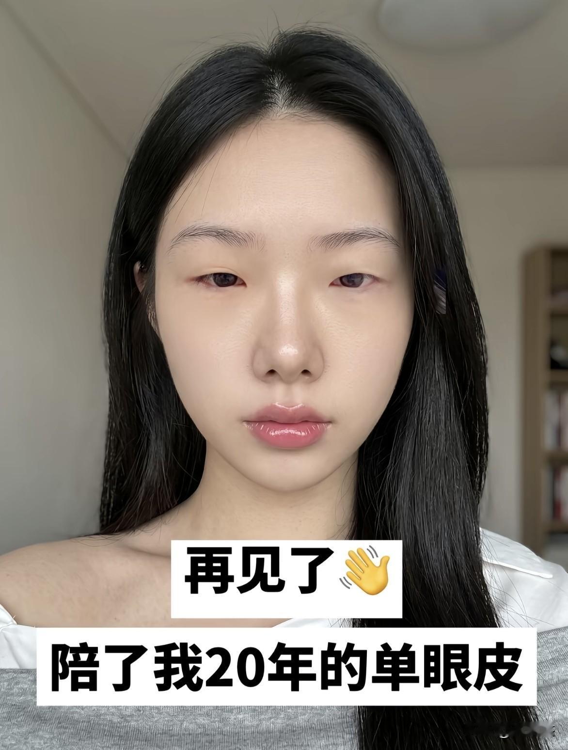 这双眼皮开得漂亮～～满分100你给几分？