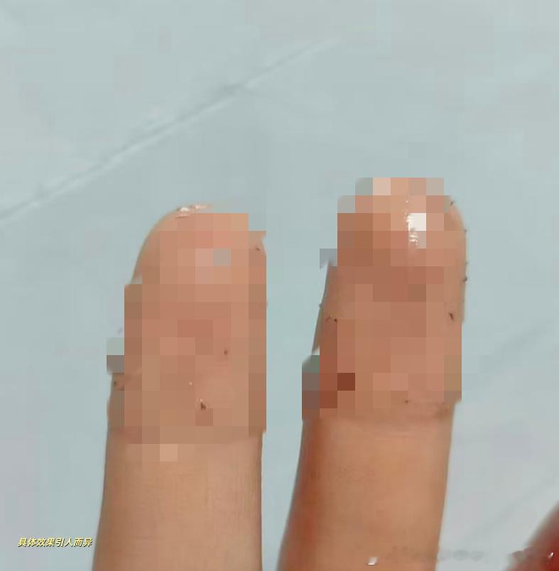 回答一位朋友的私信：为什么有上镜需求的人脸上都看不到黑头，是不是都去做了什么？本