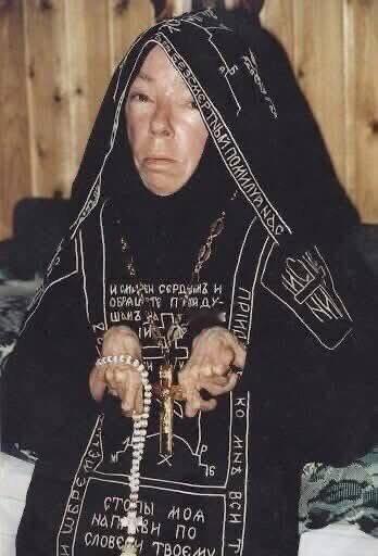 她自幼残疾，九岁起瘫痪，身形瘦小如孩童，体重仅25公斤（去世前更是只有16公斤）