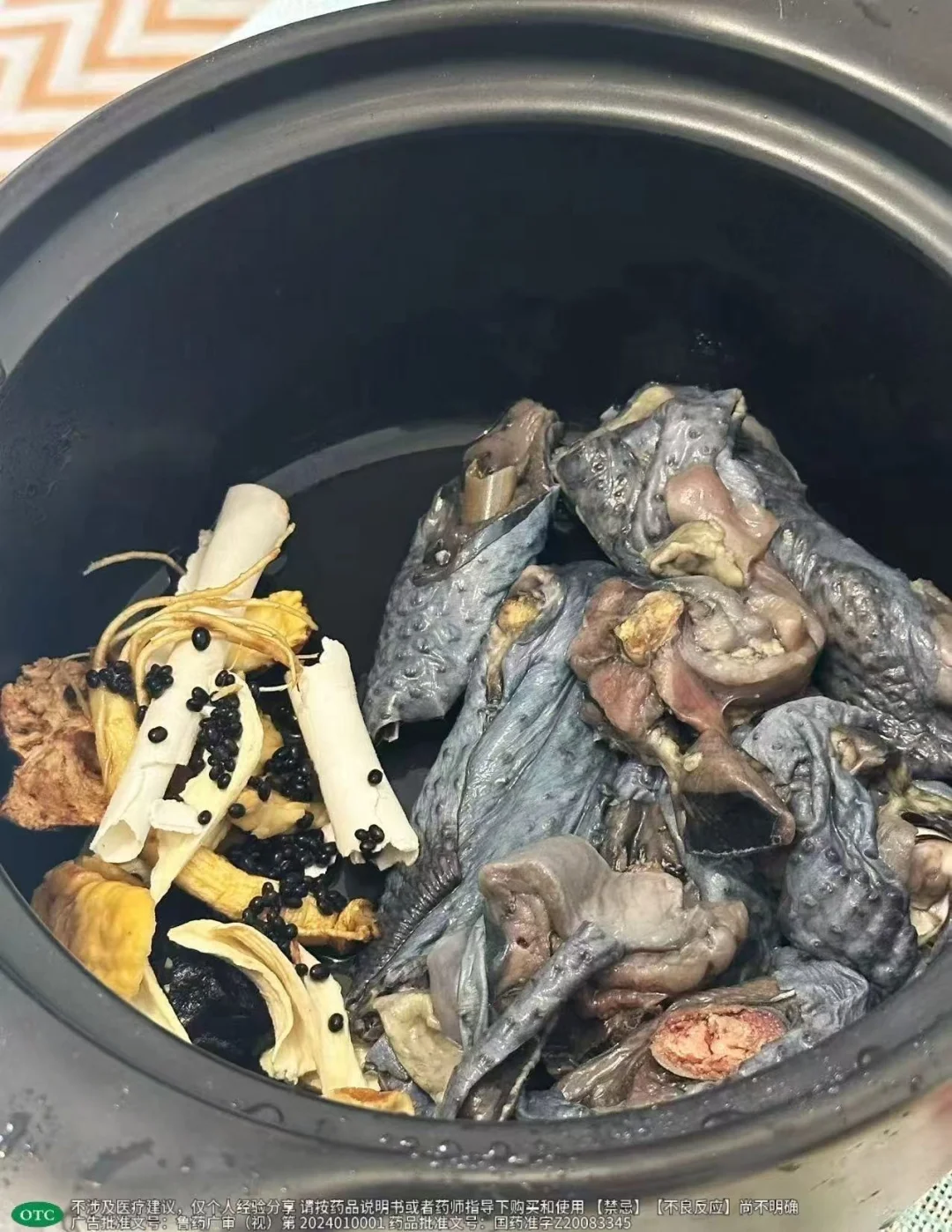 下巴长暗色痘是典型的肾气不足